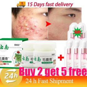 Body Acne Removal Cream Treatment Face Butt Back Acne Marks Smooth Repair Chicken Skin Cream Moisturizing Whitening Skin Care (Color: Buy 2 get 5 free)